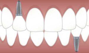 Dental treatment Carrollton